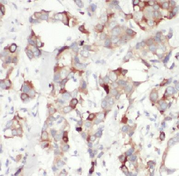 BECN1 Antibody