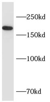 CFTR Rabbit Polyclonal Antibody