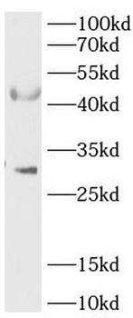 RPUSD4 Rabbit Polyclonal Antibody