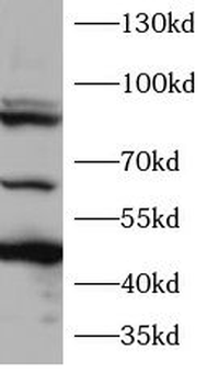 TP73 Rabbit Polyclonal Antibody