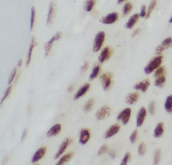 TP73 Rabbit Polyclonal Antibody