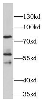 DLL1 Rabbit Polyclonal Antibody