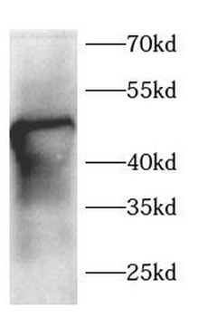 TNFRSF10A Rabbit Polyclonal Antibody