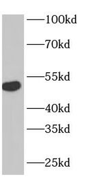TRIM72 Rabbit Polyclonal Antibody