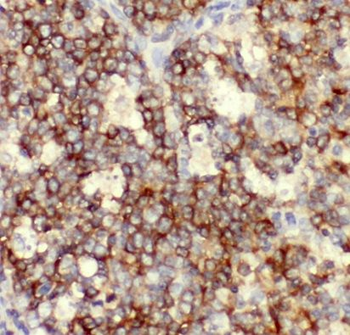 TRIM72 Rabbit Polyclonal Antibody