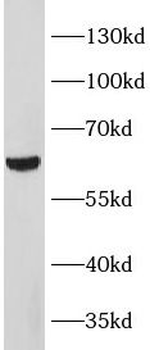 METTL14 Rabbit Polyclonal Antibody