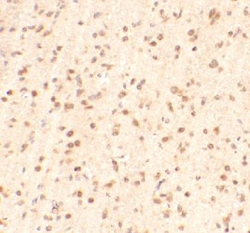 METTL14 Rabbit Polyclonal Antibody