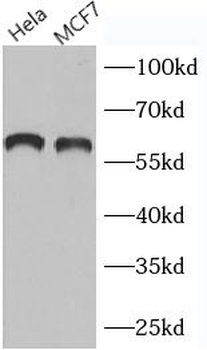 G3BP2 Rabbit Polyclonal Antibody