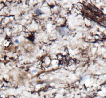 NDRG2 Mouse Monoclonal Antibody