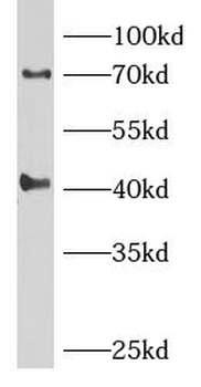 MSLN Rabbit Polyclonal Antibody