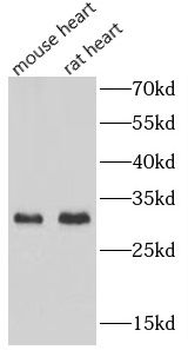BPIFA1 Rabbit Polyclonal Antibody