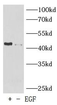 Phospho c Jun Rabbit Polyclonal Antibody