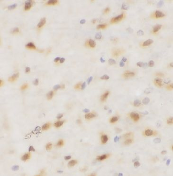 Phospho c Jun Rabbit Polyclonal Antibody