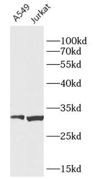 CCDC106 Rabbit Polyclonal Antibody