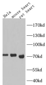 SLC25A12 Rabbit Polyclonal Antibody