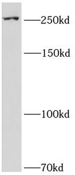 CDK5RAP2 Rabbit Polyclonal Antibody