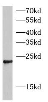 GSTP1 Mouse Monoclonal Antibody