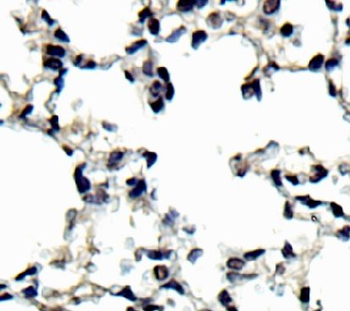 NCOA4 Antibody