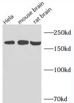 CLTC Rabbit Polyclonal Antibody