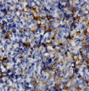 TLR9 Rabbit Polyclonal Antibody