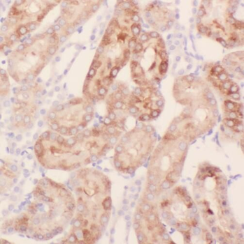 SREBF2 Rabbit Polyclonal Antibody