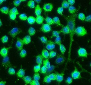 6*His His Tag Mouse Monoclonal Antibody
