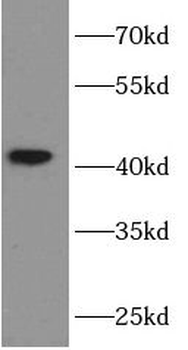 6*His His Tag Mouse Monoclonal Antibody