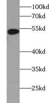 6*His His Tag Mouse Monoclonal Antibody