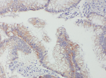 ACADL Antibody
