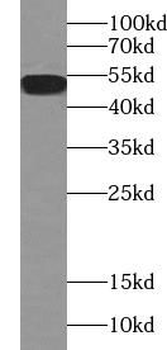 Acetylated tubulin (Lys40) Antibody