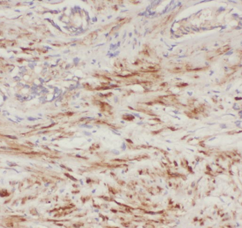 ACP3 Rabbit Polyclonal Antibody