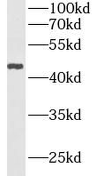 ACP3 Rabbit Polyclonal Antibody
