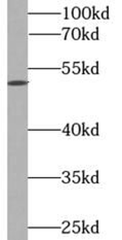 ADRA1A Rabbit Polyclonal Antibody