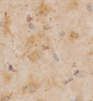 ADRA1A Rabbit Polyclonal Antibody
