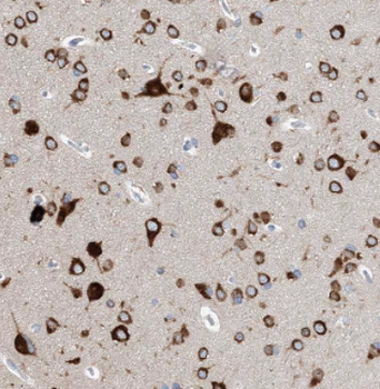 ADRA2B Specific Rabbit Polyclonal Antibody