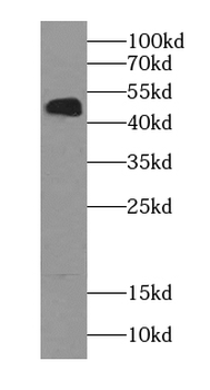 AHCY Mouse Monoclonal Antibody