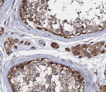 AHCY Mouse Monoclonal Antibody