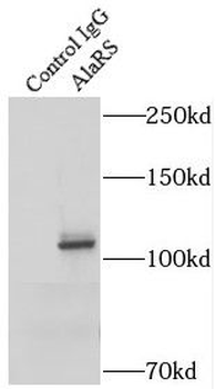 AARS1 Rabbit Polyclonal Antibody