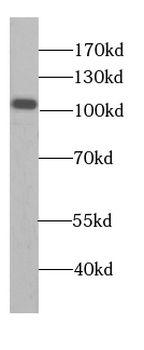 AARS1 Rabbit Polyclonal Antibody
