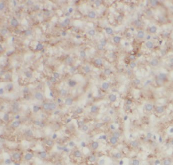 AARS1 Rabbit Polyclonal Antibody