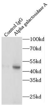 GLA Rabbit Polyclonal Antibody