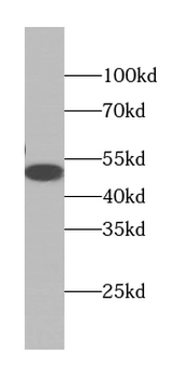 GLA Rabbit Polyclonal Antibody
