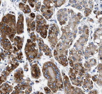 GLA Rabbit Polyclonal Antibody