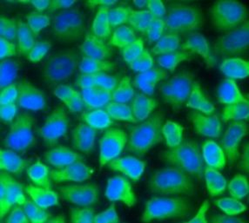 GLA Rabbit Polyclonal Antibody
