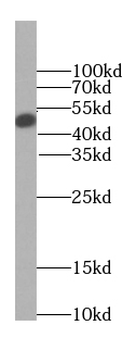 GLA Rabbit Polyclonal Antibody