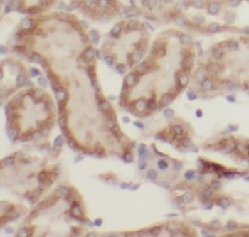 GLA Rabbit Polyclonal Antibody
