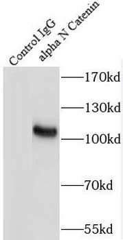 CTNNA2 Rabbit Polyclonal Antibody