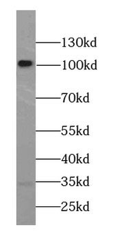 CTNNA2 Rabbit Polyclonal Antibody