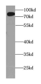 AMPD1 Specific Rabbit Polyclonal Antibody