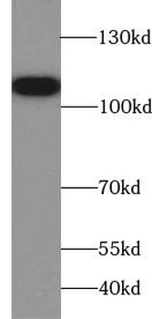 AMPH Rabbit Polyclonal Antibody